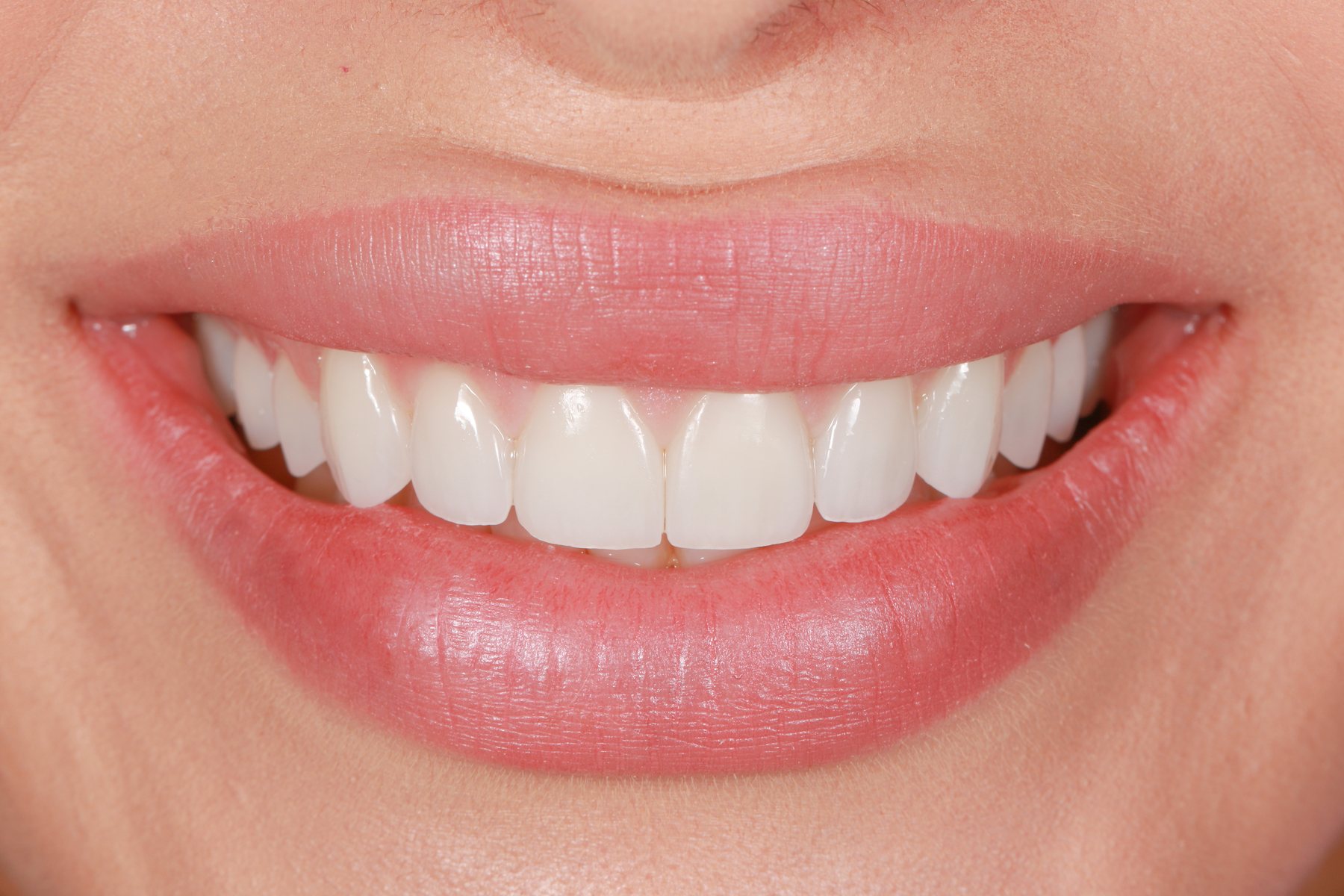 Delivered smile &middot; veneer aesthetics