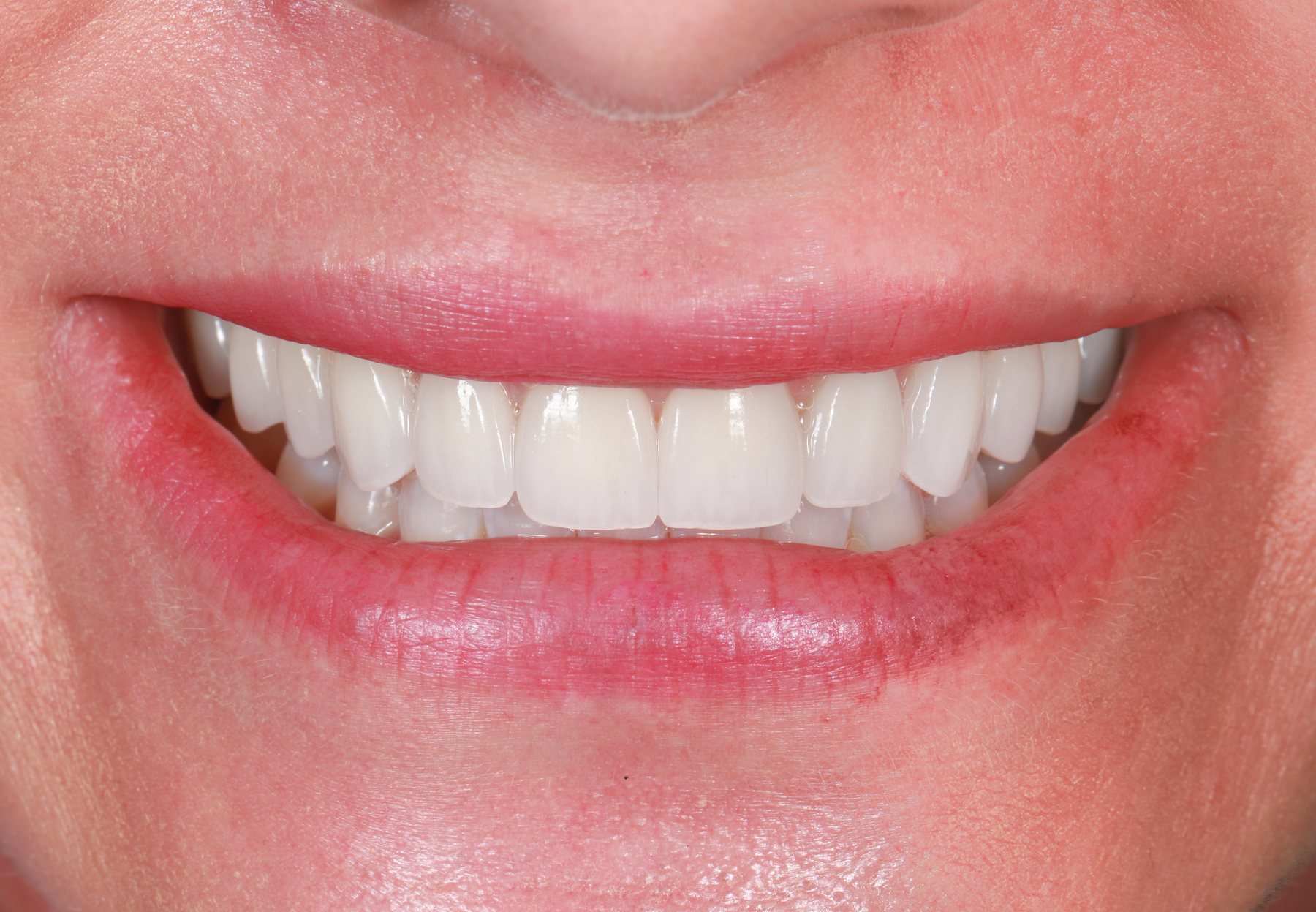 Delivered smile &middot; contour & shade