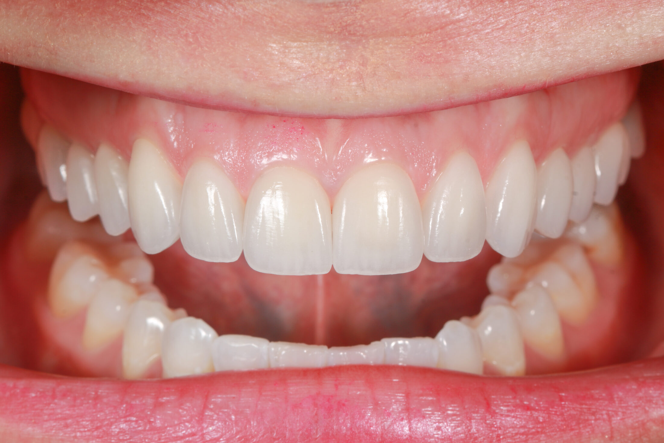 Aesthetic dentistry case study