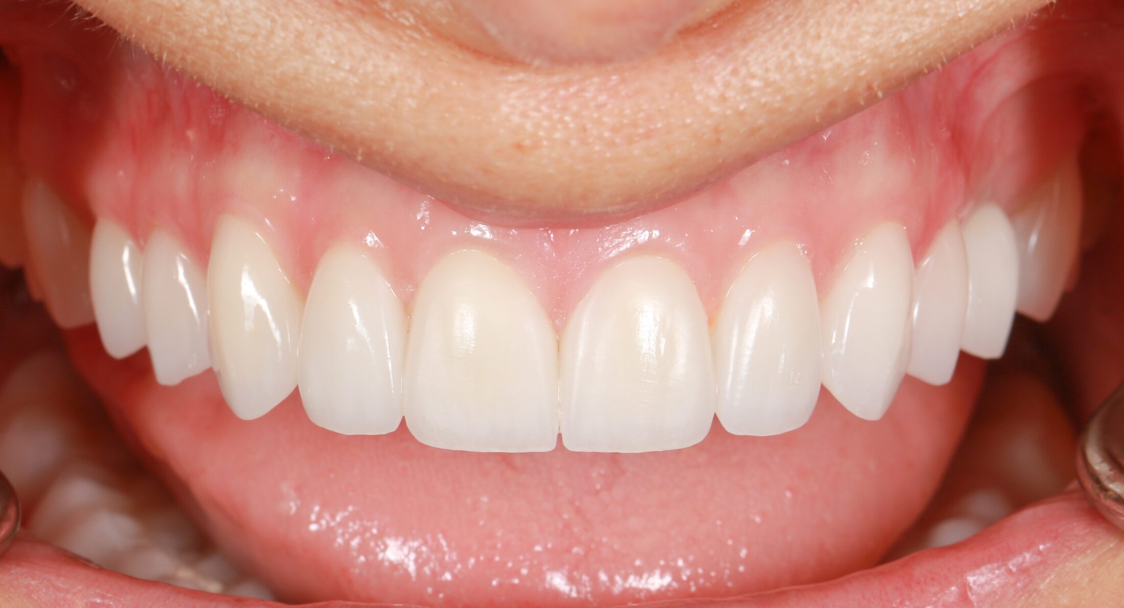 Aesthetic dentistry case study